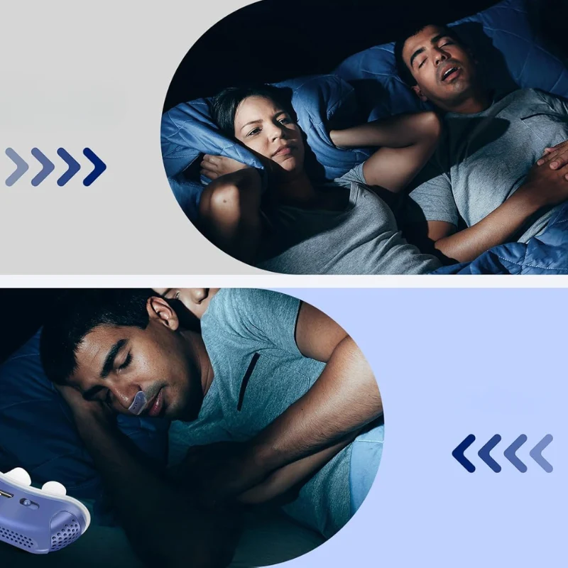 Mikro CPAP Schlafapnoe Maschine ohne Schläuche – Tragbare Anti-Schnarchen Lösung für Reisen, Flüsterleise und Kompakt